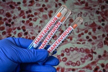Prediction Markets Are Taking Bets on the Hantavirus and Possible Pandemic