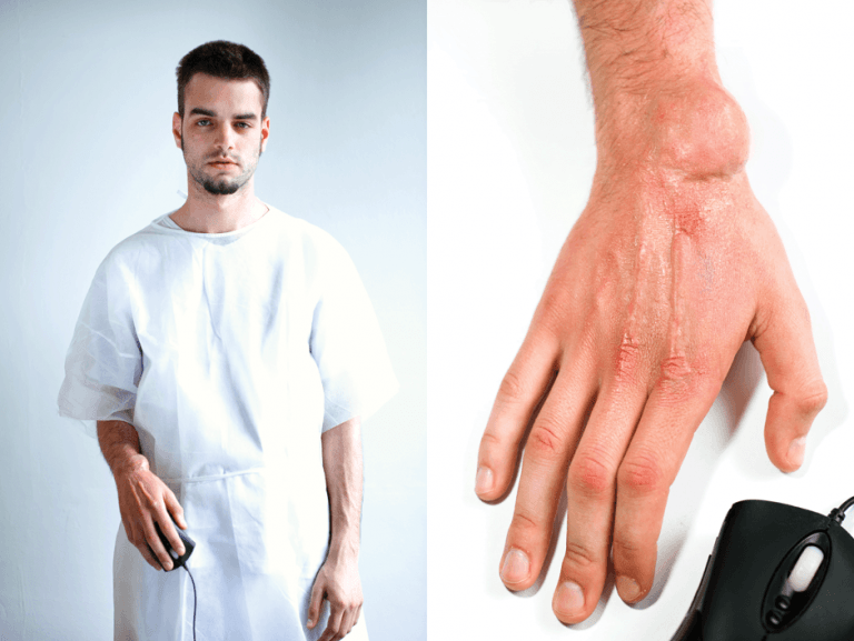 The Worst Gaming Injuries Known To Man Blog