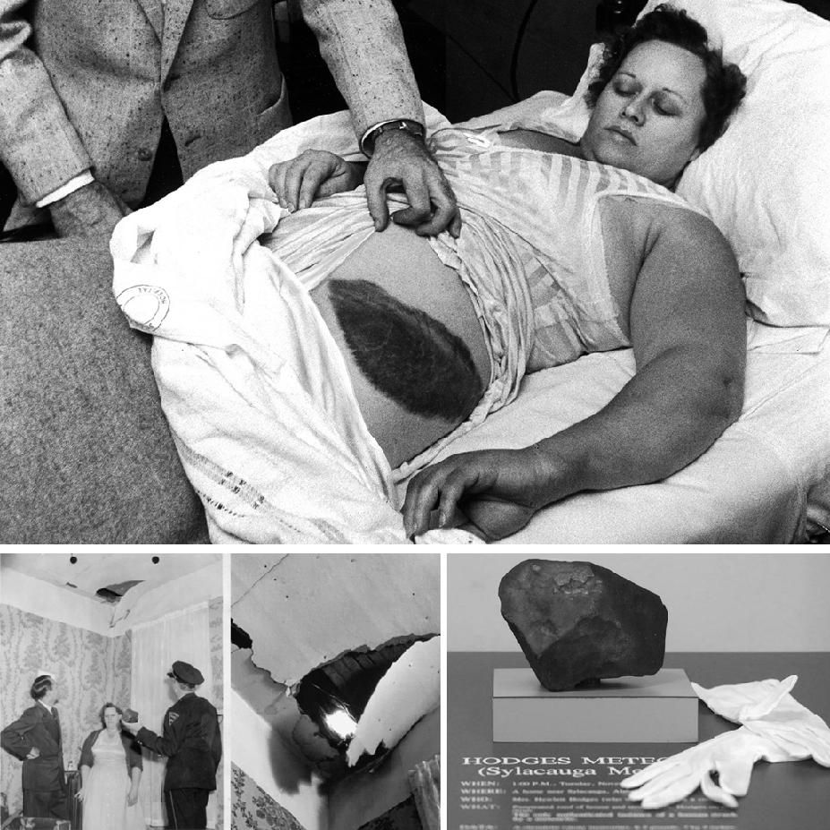 Ann Hodges and the meteorite injury she sustained.