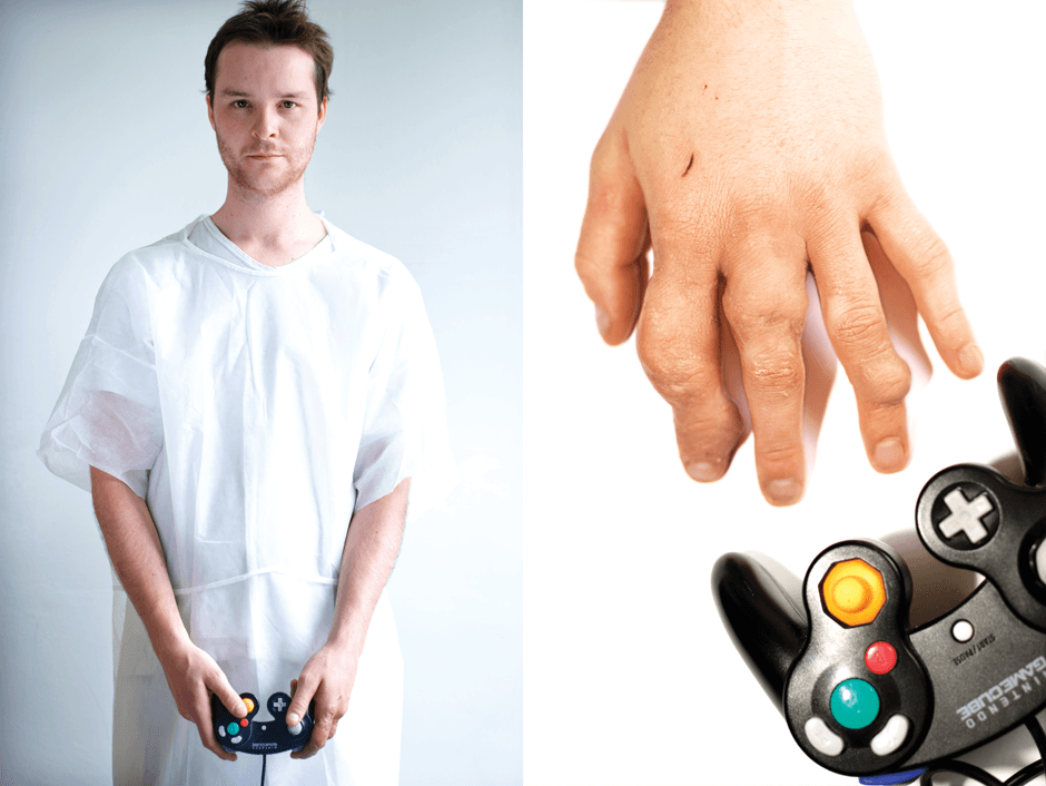 guy with arthritic hands from playing Nintendo