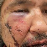 Dashcam Footage Shows Police Chokehold on Athabasca Chipewyan Chief in Alberta Casino Parking Lot