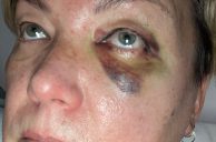 Fremont Street Uber Pickup Leads to Bloody Attack on Vegas Driver – Video 