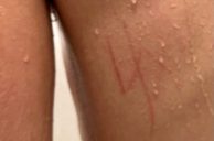 Las Vegas Crime Roundup: FBI Investigating Swastika Carved Into Back of Jewish Autistic Boy