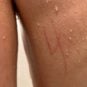 Las Vegas Crime Roundup: FBI Investigating Swastika Carved Into Back of Jewish Autistic Boy