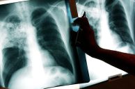 Washington State Casino-Goer Who Refuses to Isolate with TB Still at Large