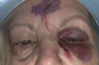 After Vegas Weed Misadventure, Howie Mandel Finds Wife in Pool of Blood