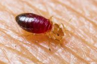 UPDATED: Strat Guest Sues Vegas Hotel After Bed Bugs Allegedly Bit Her Butt, Leg