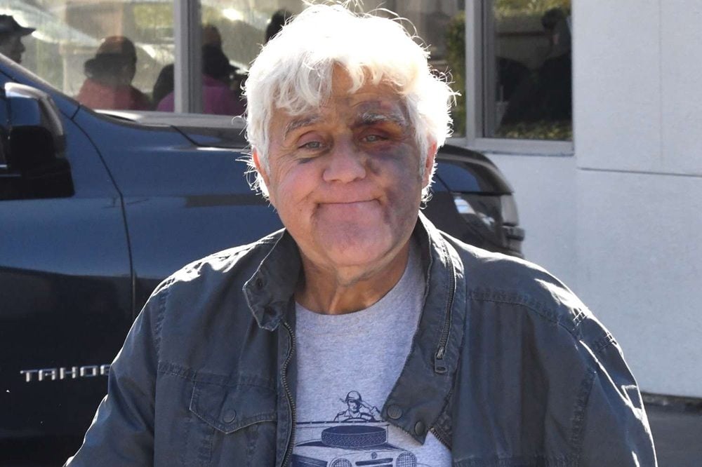 Jay Leno Debunks Gambling Debt Beatdown Rumors