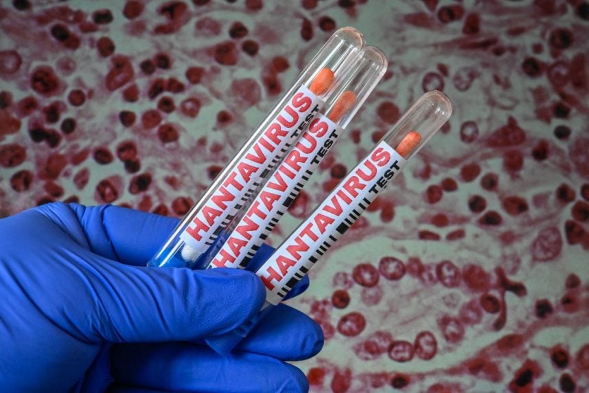 prediction markets hantavirus odds