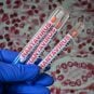 prediction markets hantavirus odds