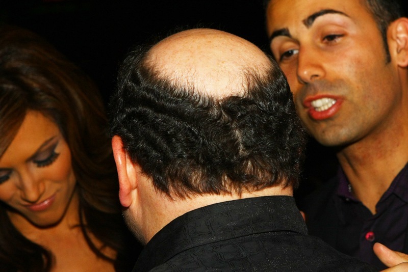 Jason Alexander