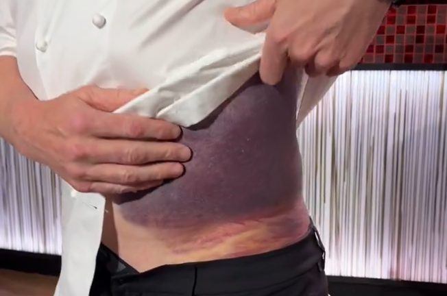 Chef Gordon Ramsay Claims He Almost Died in Biking Accident